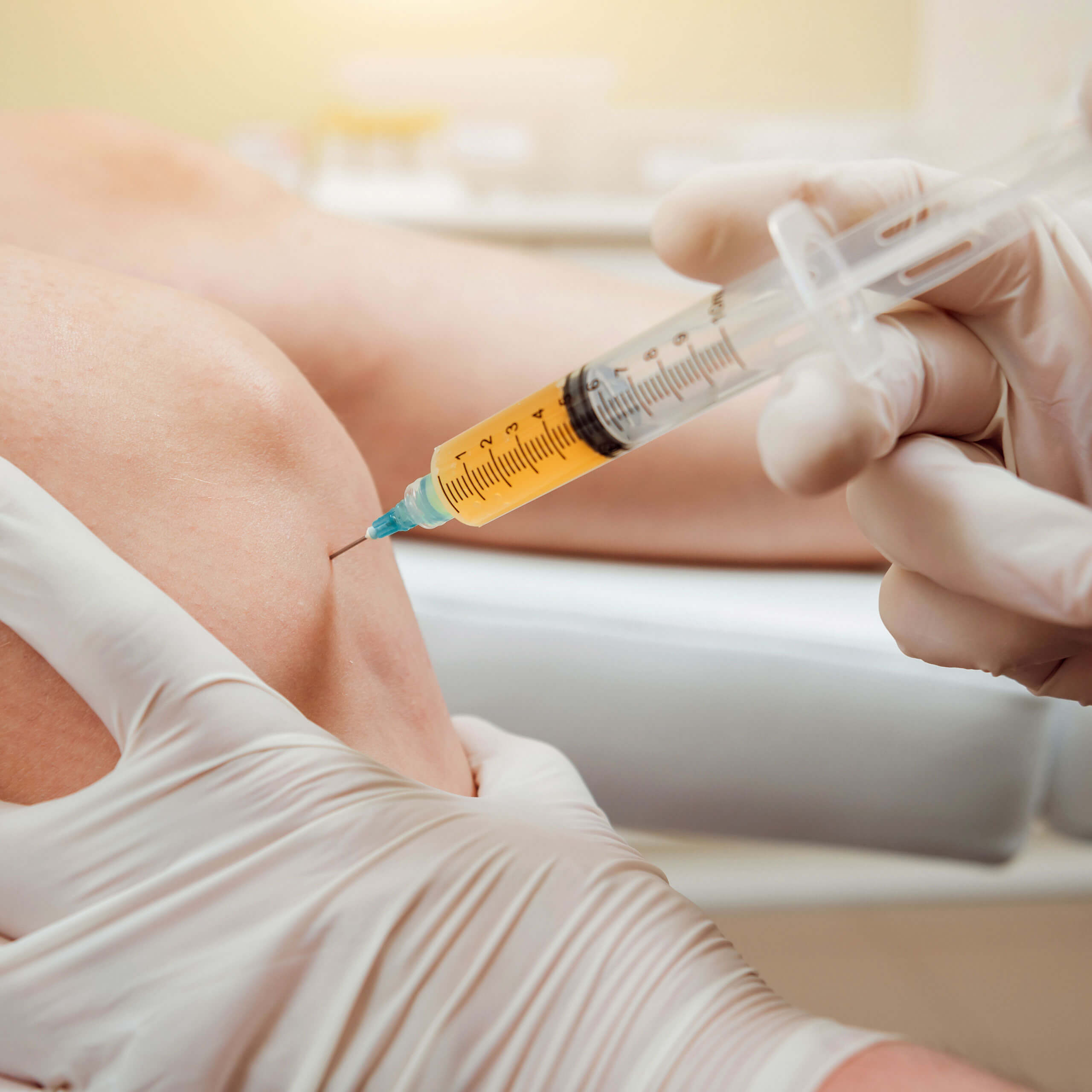 Platelet Rich Plasma (PRP) Platelet Rich Plasma (PRP)