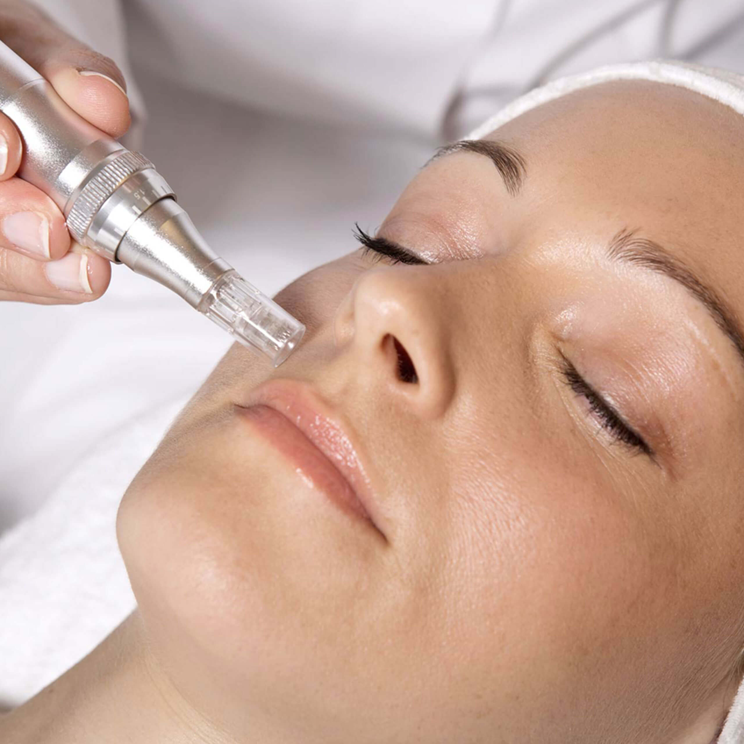 Microneedling - Dermapen Microneedling - Dermapen