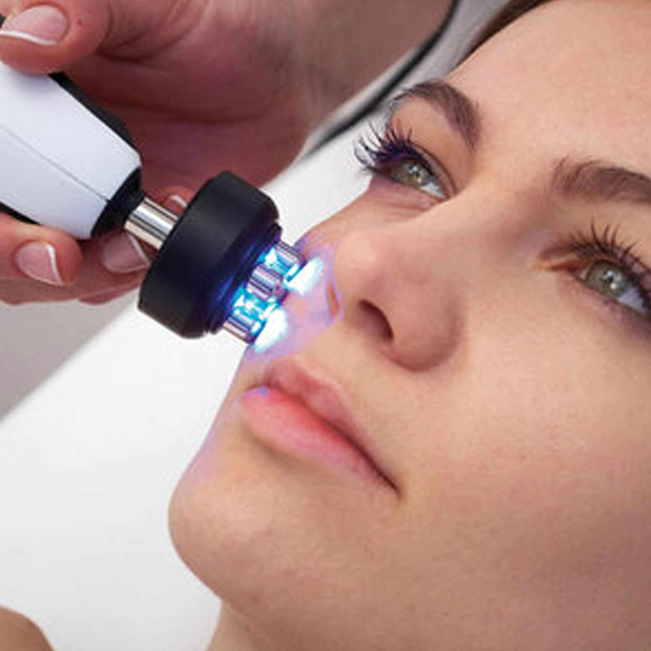 Radiofrequency Radiofrequency