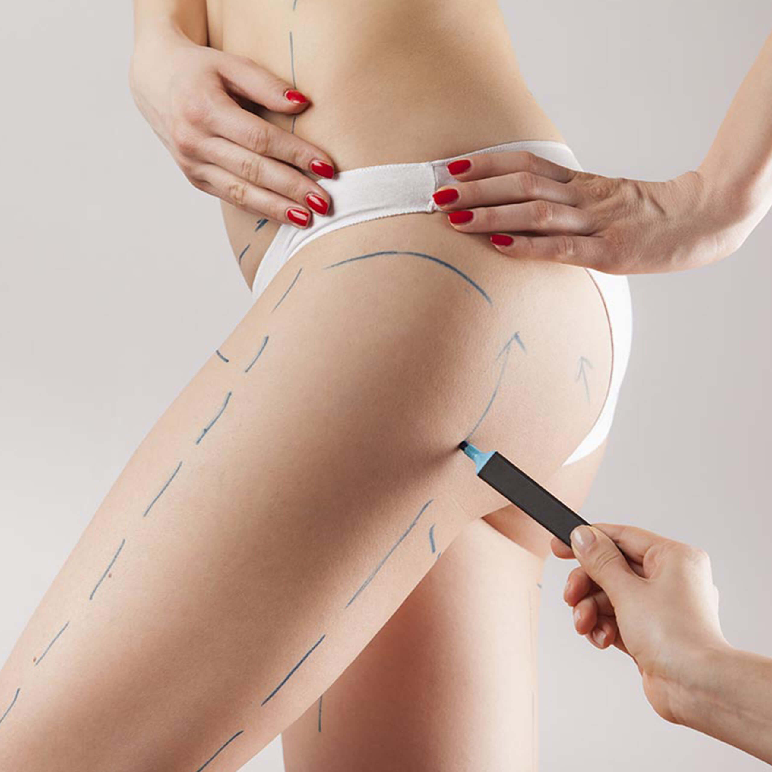 Body Contouring Body Contouring