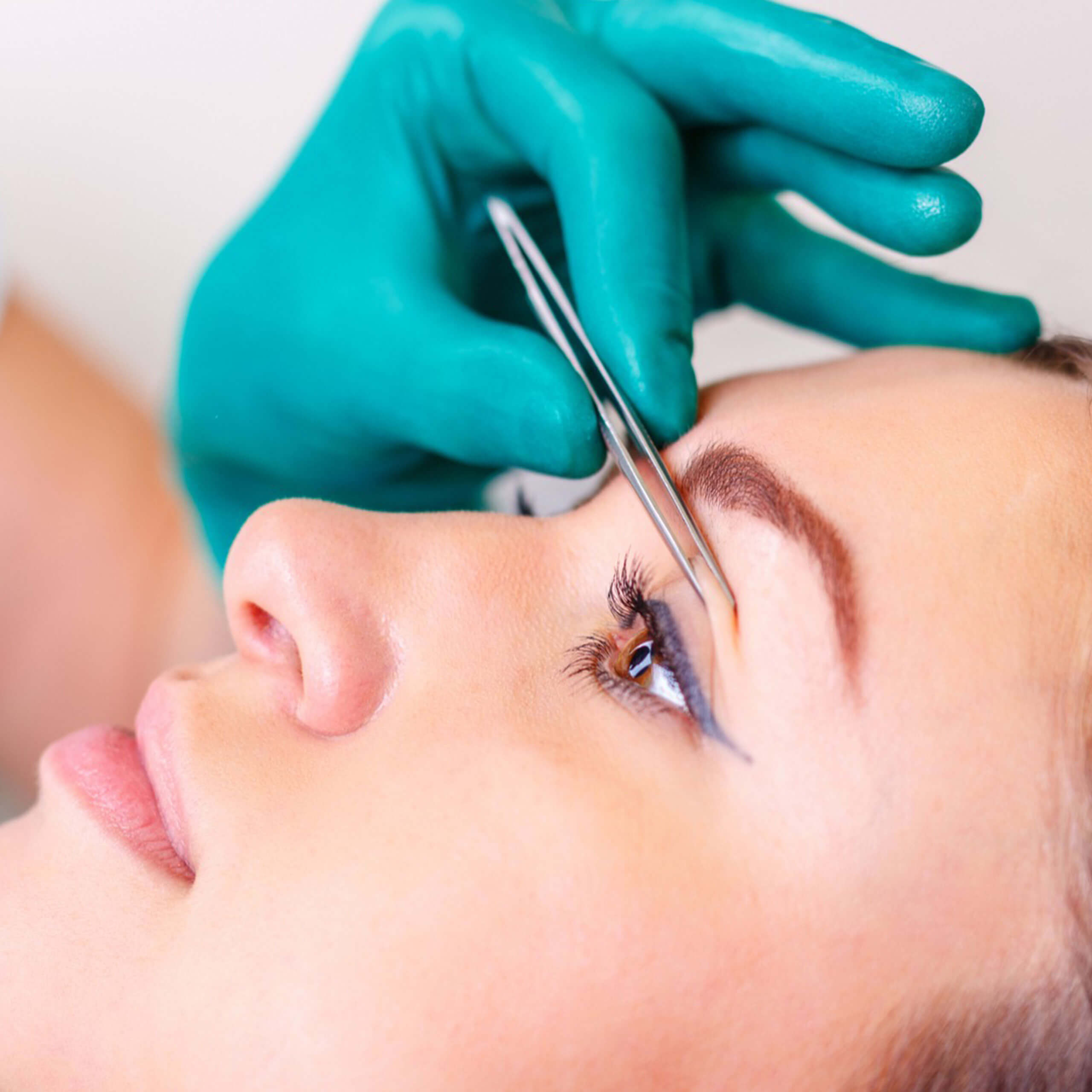 Blefaroplastia Blefaroplastia