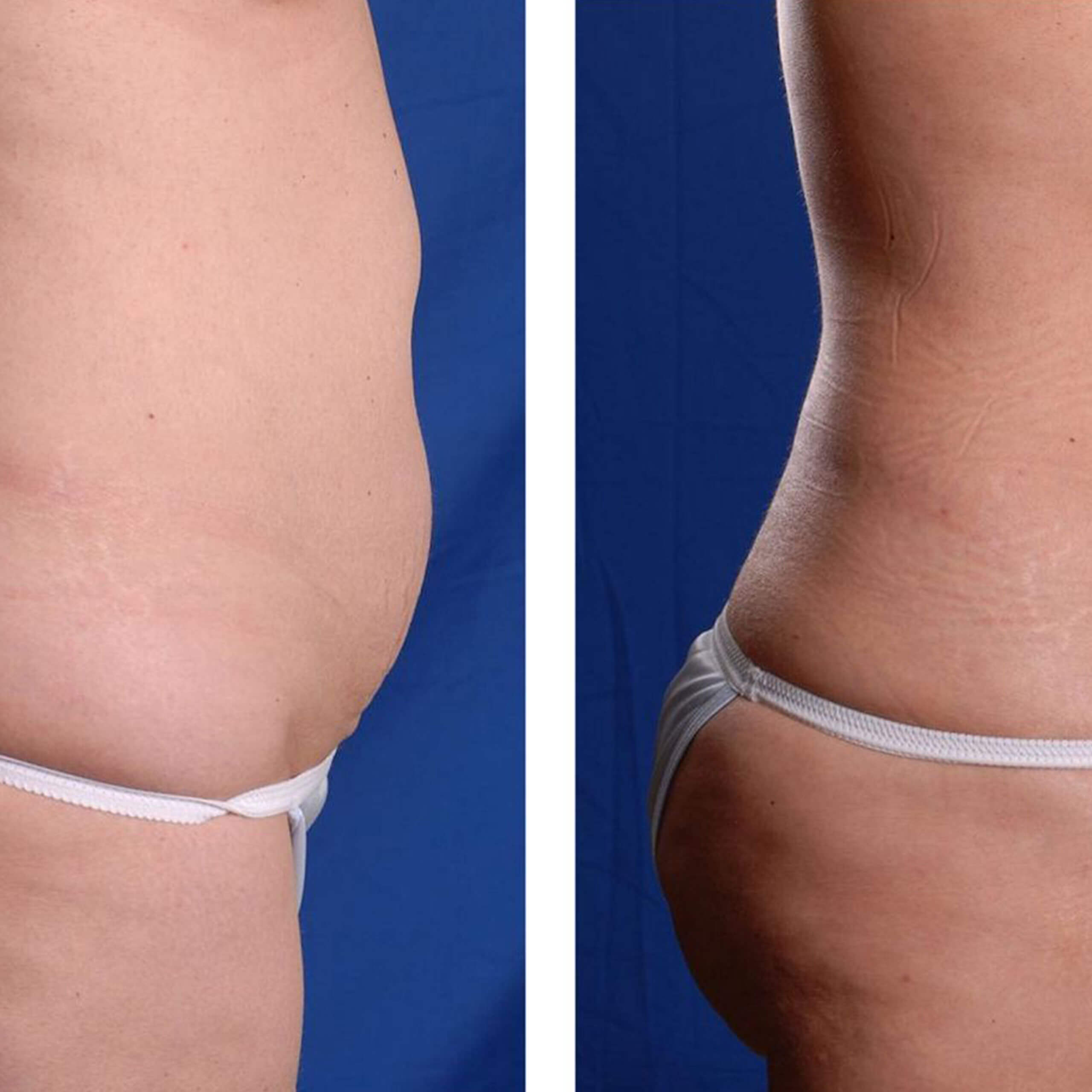 Lipoenzimas Lipoenzimas