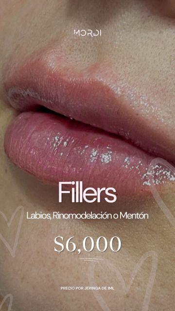 Promociones